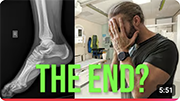 Could this END my career? | Complete rupture